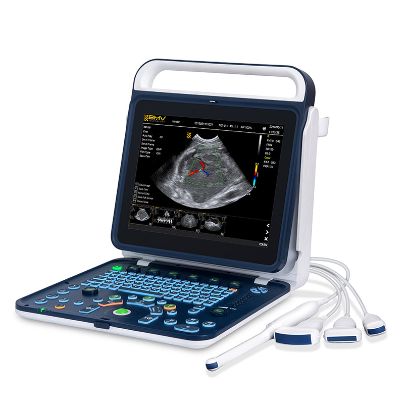 bpu60 ultrasound
