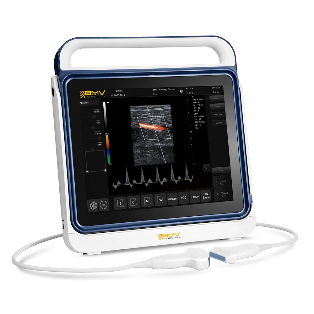 PT60 ultrasound system