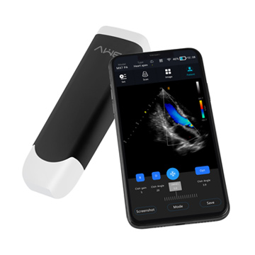 MX7 pocket ultrasound scanner