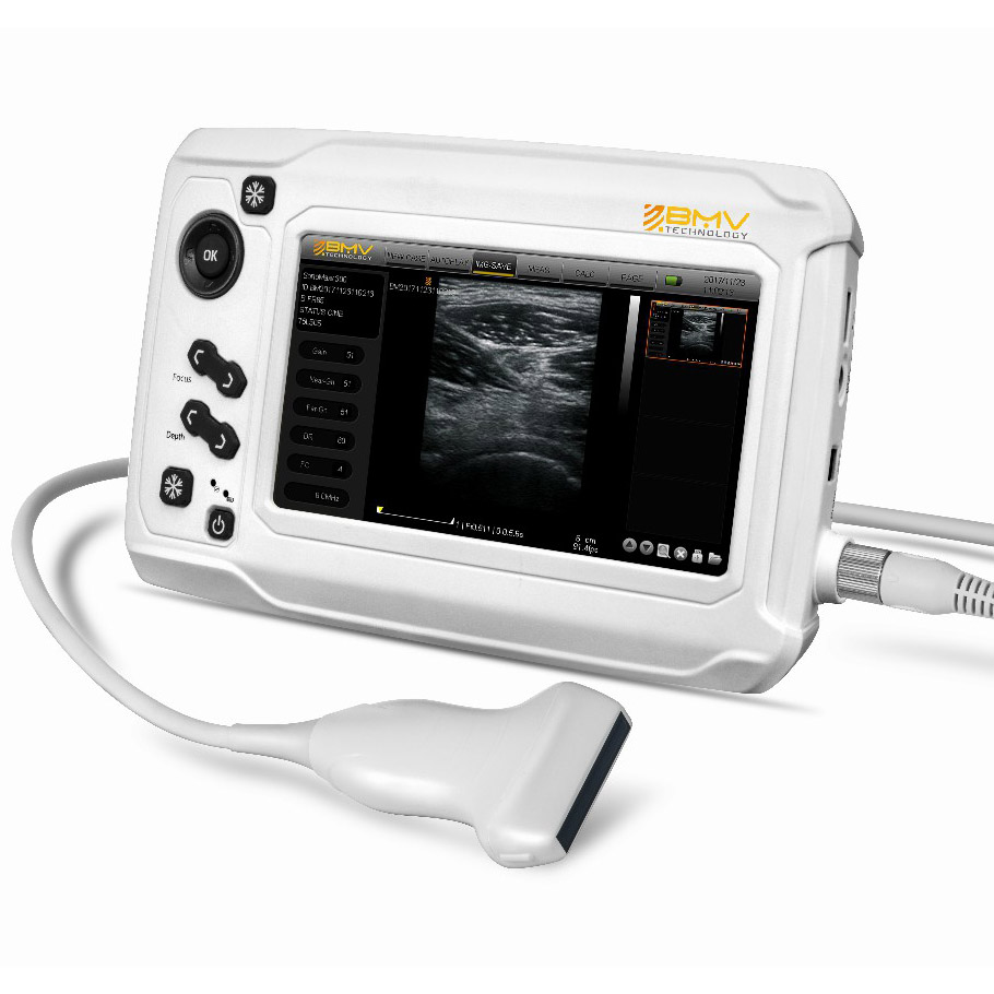 mx300 b/w ultrasound scanner
