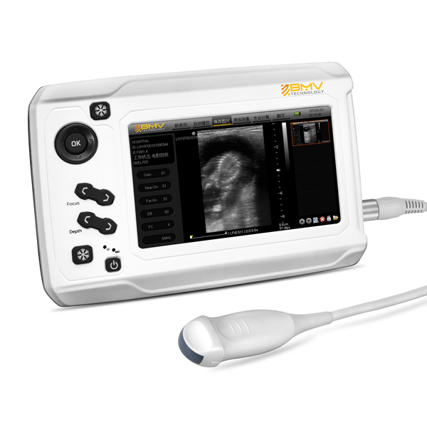 MX300 ultrasound system