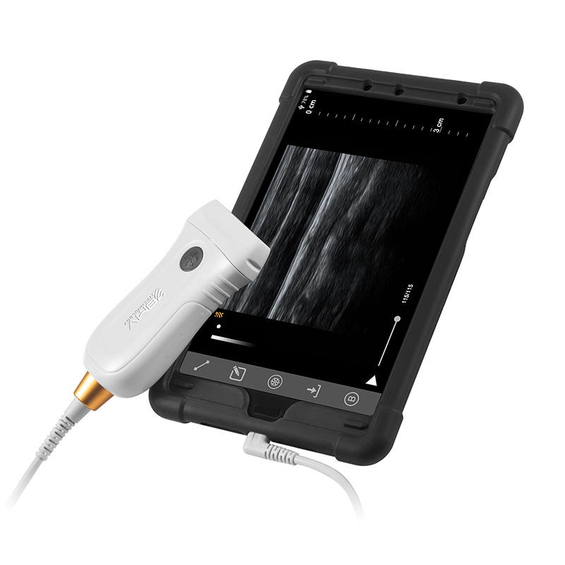 MX5 ultrasound
