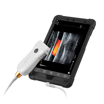 MX5 ultrasound