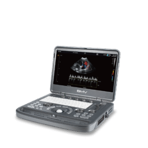 BPU80 Cardiac Ultrasound