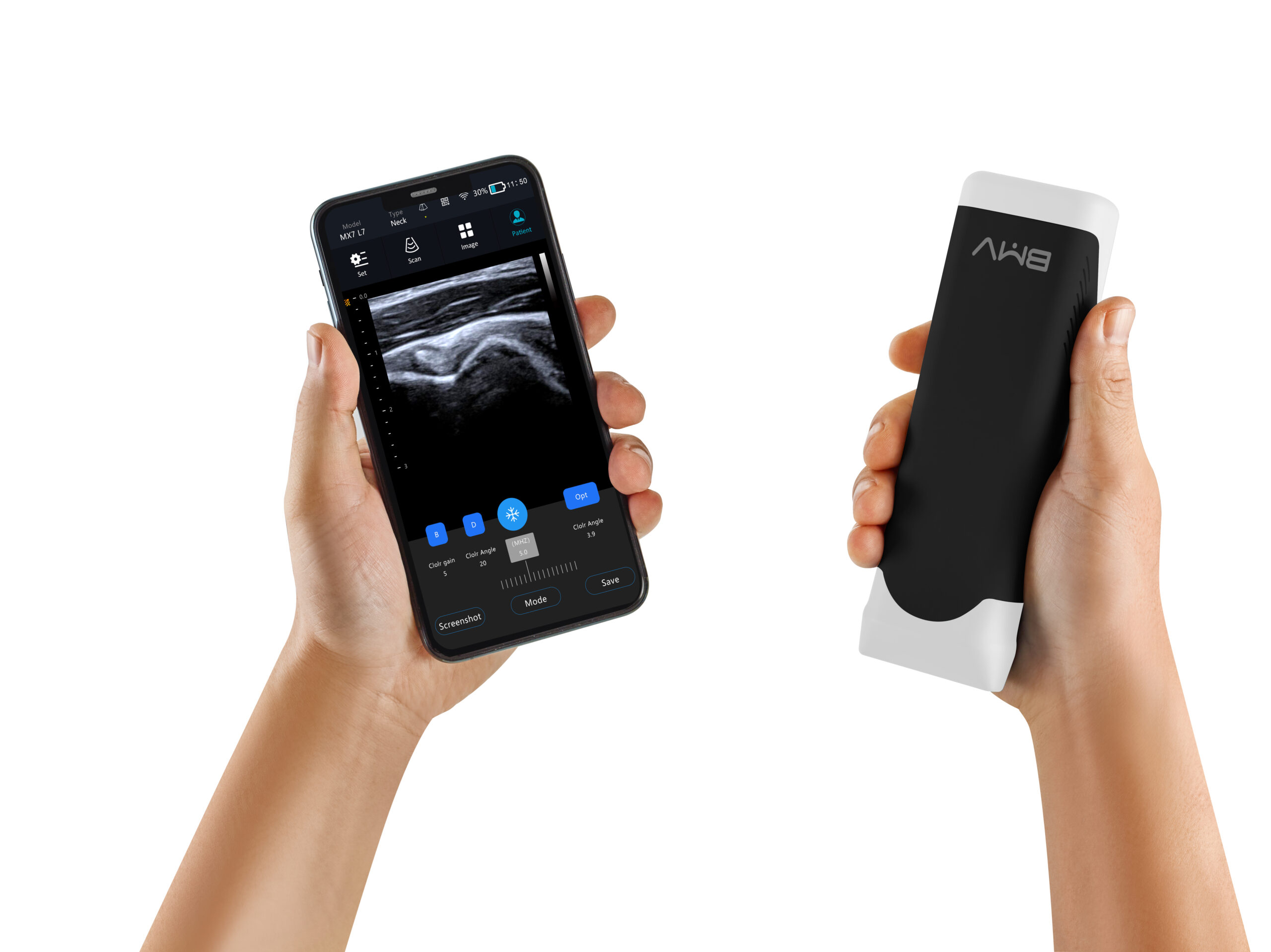 MX7 Series Wireless Handheld Ultrasound Probe – 64-Channel 192-Element Phased Array & Multi-Probe Options