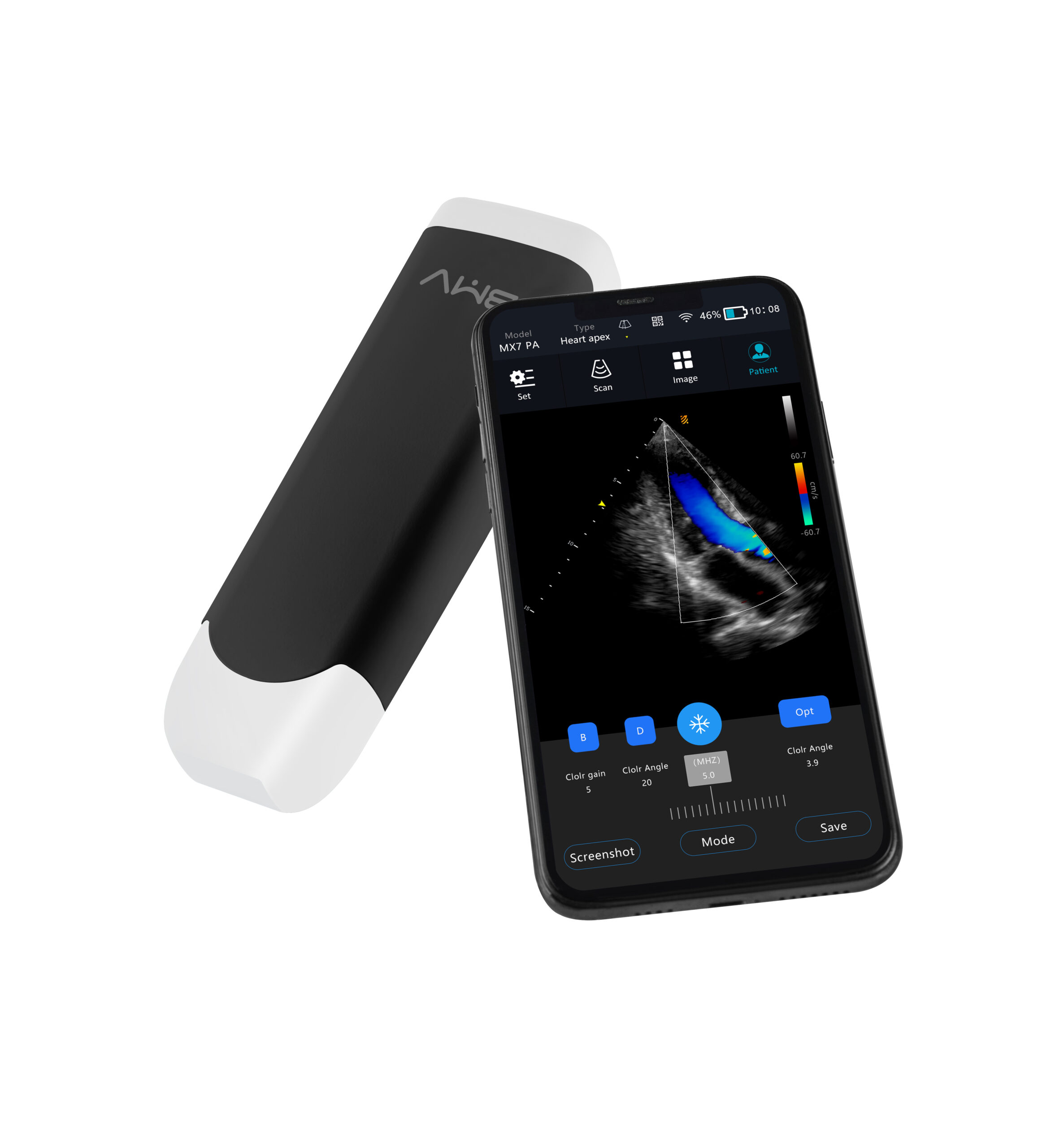 MX7 Series Wireless Handheld Ultrasound Probe – 64-Channel 192-Element Phased Array & Multi-Probe Options - Image 4